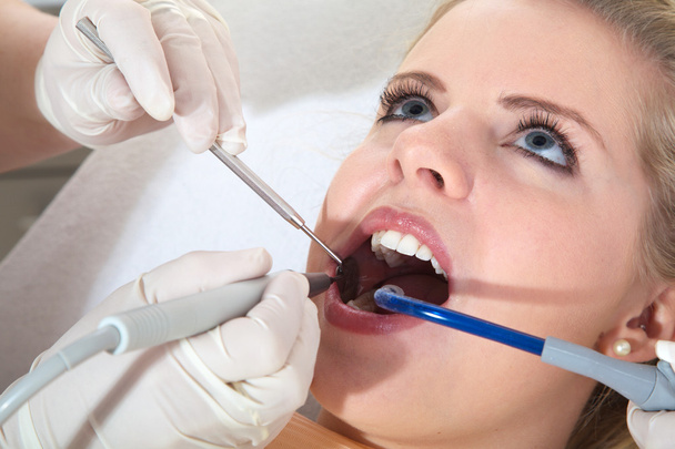 Cosmetic dental cleaning - Valokuva, kuva