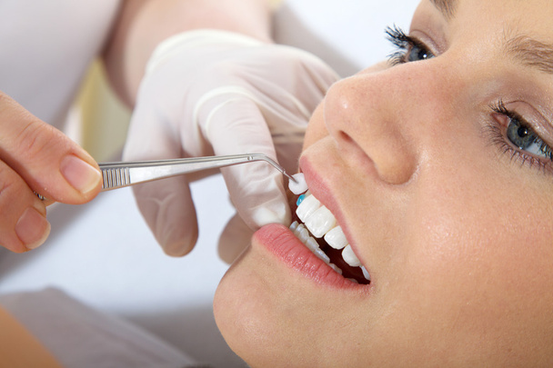 Cosmetic dental cleaning - Zdjęcie, obraz