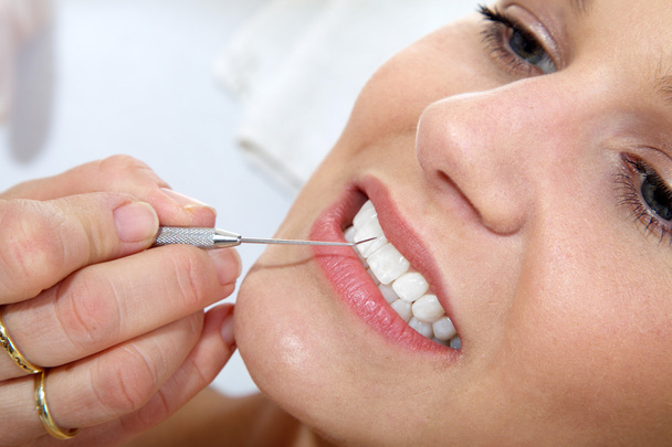Cosmetic dental cleaning - Фото, изображение