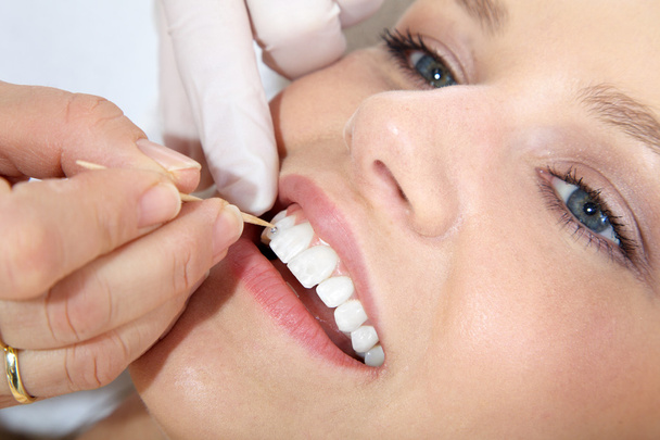 Cosmetic dental cleaning - Фото, изображение