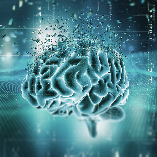 3D lääketieteellinen kuva osoittaa aivojen murskaamista
 - Valokuva, kuva