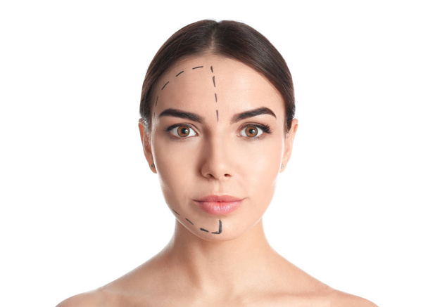 Młoda kobieta ze znakami na twarzy do operacji kosmetycznych na białym tle - Zdjęcie, obraz
