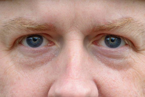 Chiudi gli occhi azzurri di un uomo dai capelli rossi
 - Foto, immagini