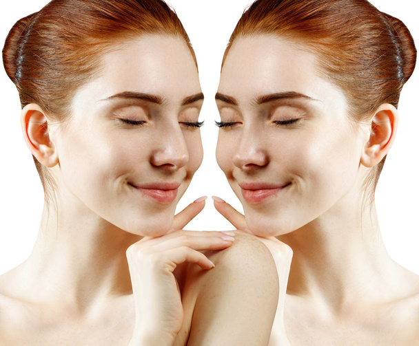 Nez féminin avant et après la chirurgie esthétique
. - Photo, image
