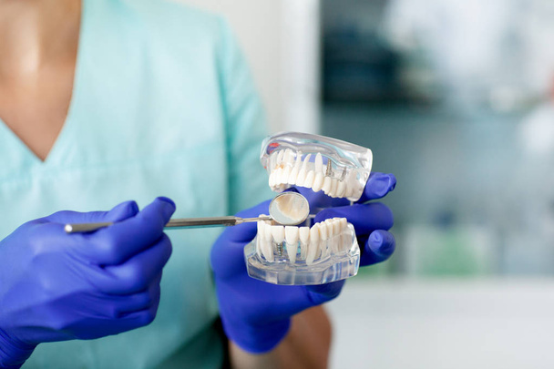 Een tandarts houdt een monster van de kaak tanden in een tandheelkundige kantoor. - Foto, afbeelding