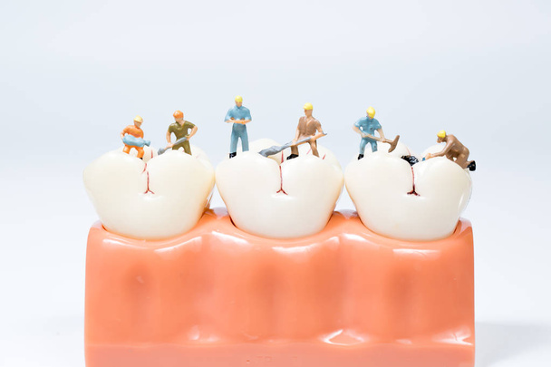 мініатюрні люди очищають модель зуба, медична концепція
 - Фото, зображення
