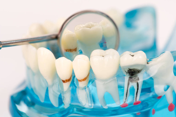 об'єкт стоматологічної моделі з зубним інструментом
 - Фото, зображення