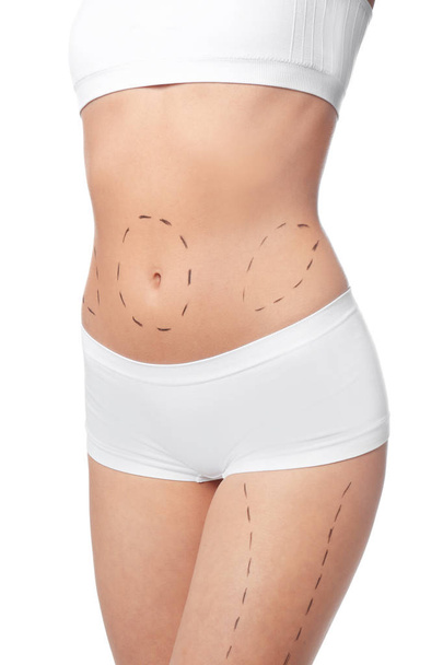 Young woman with marks on body for cosmetic surgery operation against white background, closeup - Photo, image