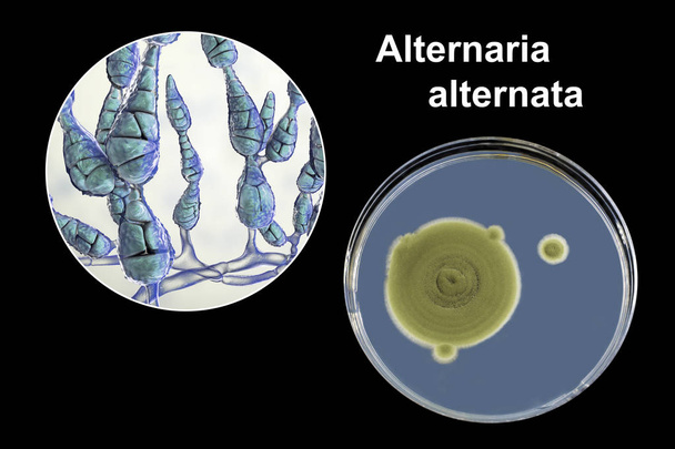 Küf Alternaria alternata, besin ortamında koloninin resmi ve fotoğrafı - Fotoğraf, Görsel