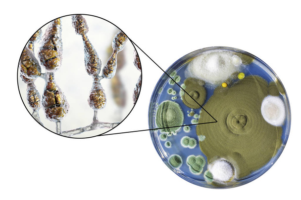 Mold Alternaria alternata, illustration and photo of colony on nutrient medium - Photo, Image