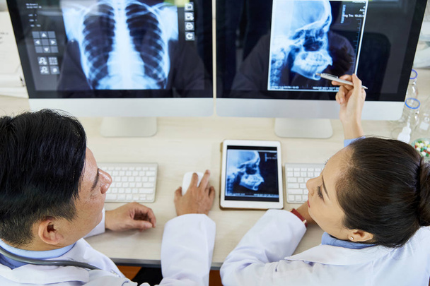Due radiologi asiatici seduti al tavolo davanti a monitor di computer con immagini a raggi X e discutendo la diagnosi in team in ufficio
 - Foto, immagini