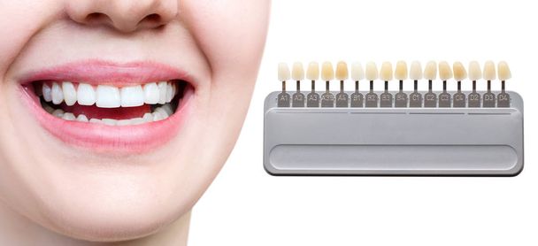 Collage de paleta de dientes con blanqueamiento de dientes femeninos
. - Foto, imagen