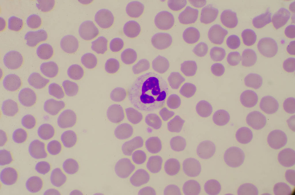 Neutrophil v sepse patein Najdi s mikroskopem. - Fotografie, Obrázek