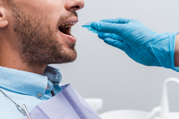περικομμένη όψη του οδοντίατρου στο γάντι λατέξ κρατώντας προκαταβολή κοντά σε άνθρωπο με ανοιχτό στόμα  - Φωτογραφία, εικόνα