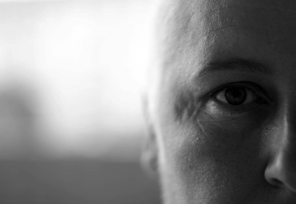Bald women half face shot noir et blanc
 - Photo, image