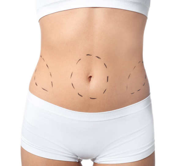 Young woman with marks on body for cosmetic surgery operation against white background, closeup - Photo, Image