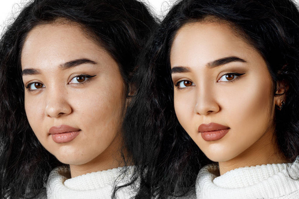 Young girl with problem skin before and after retouch. - Photo, Image
