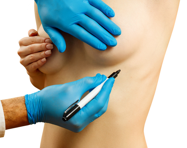 Cirugía plástica antes de la corrección de mama femenina
. - Foto, Imagen