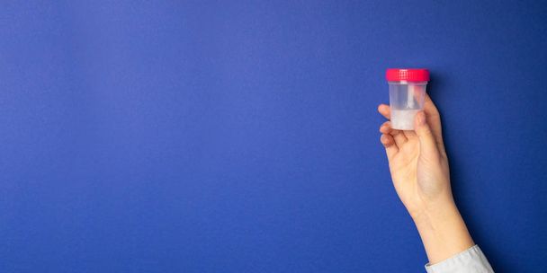 尿検査用の瓶尿サンプル用プラスチック瓶 - 写真・画像