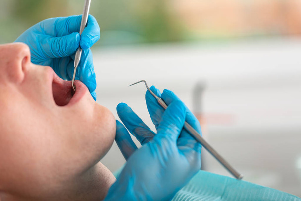 Zubařka prohlíží dutinu ústní pacienta nástrojem se zrcadlem. Detailní portrét pacienta s otevřenými ústy, lékař v rukavicích drží zubní zrcadlo. - Fotografie, Obrázek
