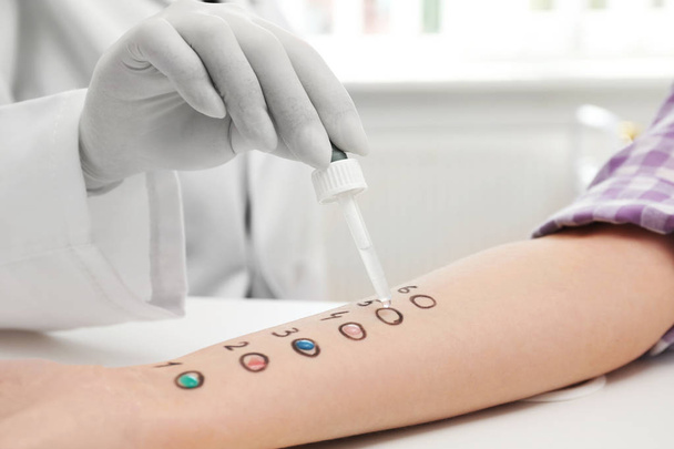 Patient undergoing skin allergy test at light table, closeup - Photo, Image