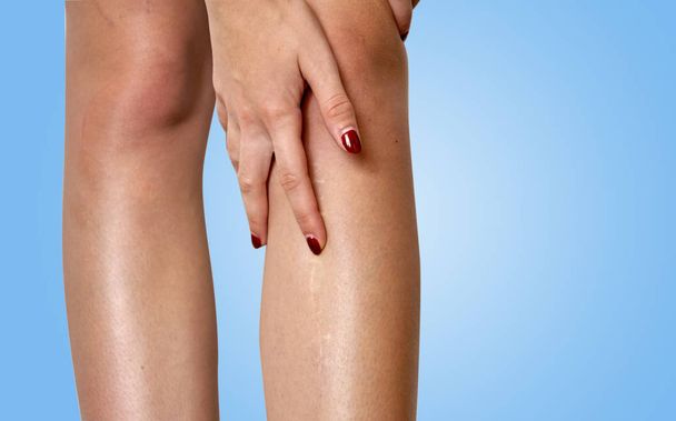 The scar on the leg. Bone fracture or tumor removal. Recobvery. isolated medical on white background - Foto, Bild