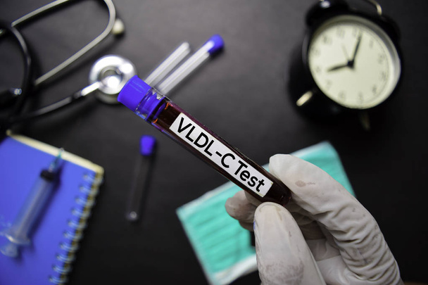 VLDL-C - тест із зразком крові. Вид зверху ізольовано на чорному тлі. Охорона здоров'я/ Медична концепція
 - Фото, зображення