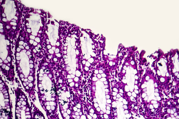Bacilláris vérhas, fénymikrográf - Fotó, kép