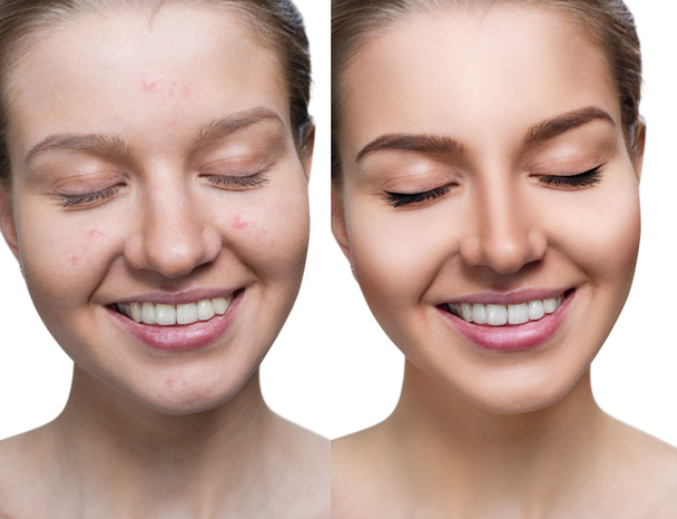 Νεαρή γυναίκα πριν και μετά την επεξεργασία και το μακιγιάζ του δέρματος. - Φωτογραφία, εικόνα