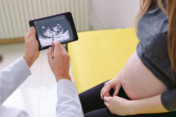 Ginekolog pokazując echo zdjęcie do kobiety w ciąży. - Zdjęcie, obraz