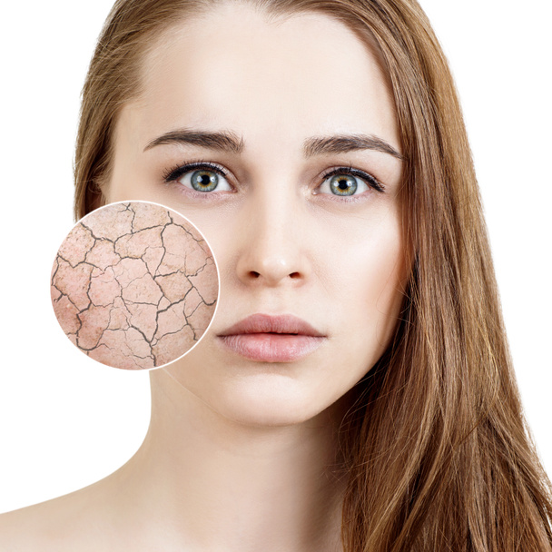 Zoom circle shows dry facial skin before moistening. - Photo, Image