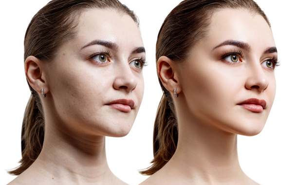 Comparison portrait of young woman before and after retouch. - Photo, Image