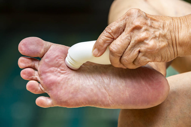 Seniorenhand mit schmerzstillender Flüssigkeit, Muskelschmerzlinderrolle am Fuß, blauer Swimmingpool-Hintergrund, asiatischer Körperhautteil, über Massage, Gesundheitskonzept - Foto, Bild