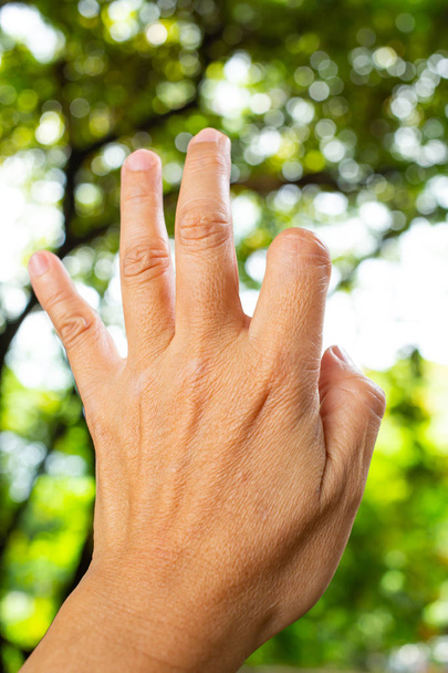 Замок пальца триггера на большом пальце и указательном пальце левой руки женщины, страдает от боли, в зеленом боке фон сада, Закрыть и Макро выстрел, Синдром офиса, концепция здравоохранения
 - Фото, изображение