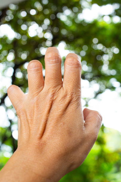 Зажим пальца триггера на пальцах левой руки женщины, страдает от боли, в зеленом боке фоне сада, Закрыть и Макро выстрел, Синдром офиса, концепция здравоохранения
 - Фото, изображение
