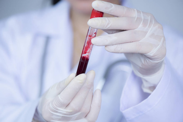 Селективный фокус руки врача, держащего бутылку крови
  - Фото, изображение