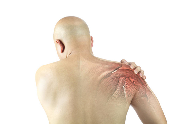 ώμος τραυματισμός μυών λευκό φόντο πόνος στον ώμο - Φωτογραφία, εικόνα