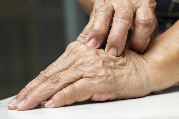 Die rechte Hand der Seniorin zerkratzt ihre linke Hand, auf weißem Tischhintergrund, Nahaufnahme, asiatischer Körperteil, Gesundheitskonzept - Foto, Bild