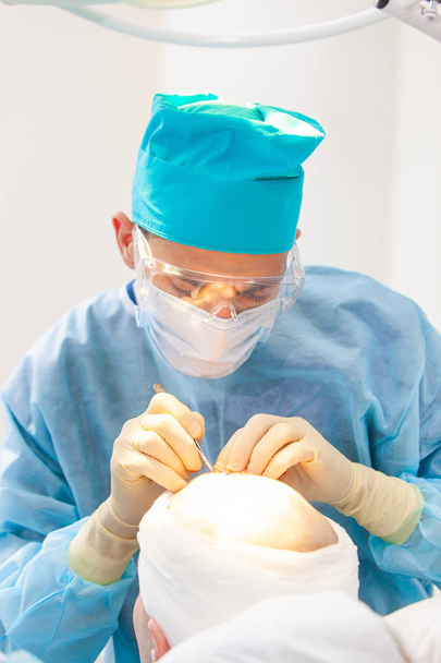 Θεραπεία της φαλάκρα. Μεταμόσχευση μαλλιών. Χειρούργοι στο χειρουργείο διεξάγουν εγχείρηση μεταμόσχευσης μαλλιών. Χειρουργική τεχνική που μετακινεί τα τριχοθυλακίων από ένα μέρος του κεφαλιού. - Φωτογραφία, εικόνα