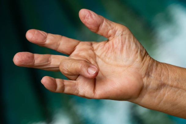 シニア女性の右手の薬指に指ロックをトリガー, 痛みに苦しむ, スイミングプールの背景, ヘルスケアの概念 - 写真・画像
