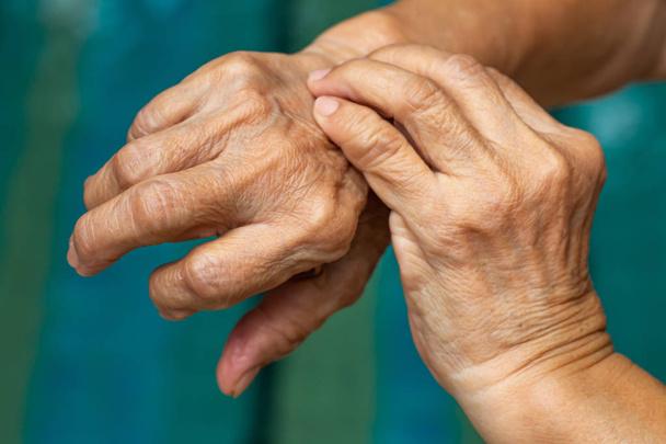 Die linke Hand der Seniorin zerkratzt ihre rechte Hand, blauer Swimmingpool-Hintergrund, Nahaufnahme, asiatischer Körperteil, Gesundheitskonzept - Foto, Bild