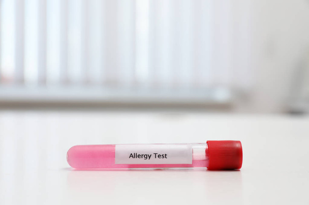 Tube with label ALLERGY TEST on white table, space for text - Photo, Image