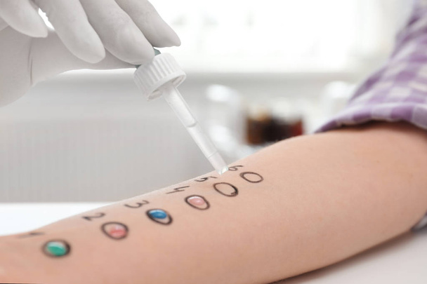 Patient undergoing skin allergy test at light table, closeup - Foto, afbeelding