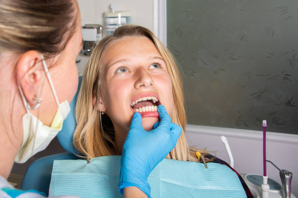 Stomatologie. Pacient je dospívající dívka s otevřenou pusou. Doktor kontroluje zuby, zblízka, pohled zepředu. - Fotografie, Obrázek
