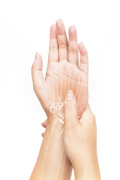 hueso de la mano dolor fondo blanco lesión de la mano
 - Foto, Imagen