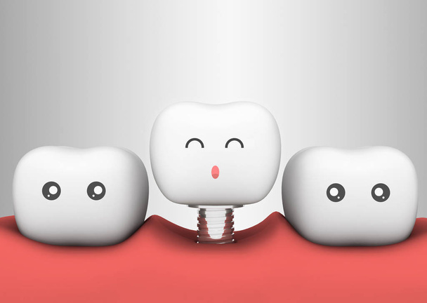 dente 3D conceito dente artificial
 - Foto, Imagem