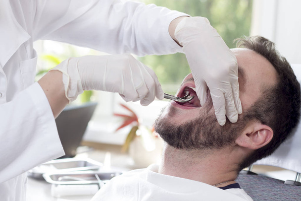 Um homem branco está sentado numa cadeira dentária com a boca bem aberta. As mãos do dentista em luvas brancas agarram o dente com garras
. - Foto, Imagem