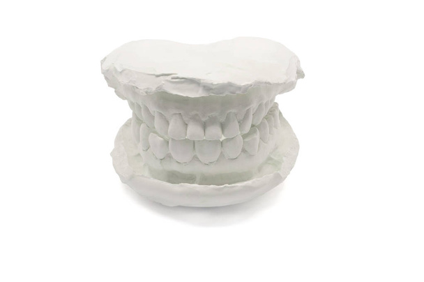Tandheelkundige model op witte achtergrond, geïsoleerd. Gipsmodel kaak met kunstmatige tandheelkundige ontwerpen met uitknippad - Foto, afbeelding