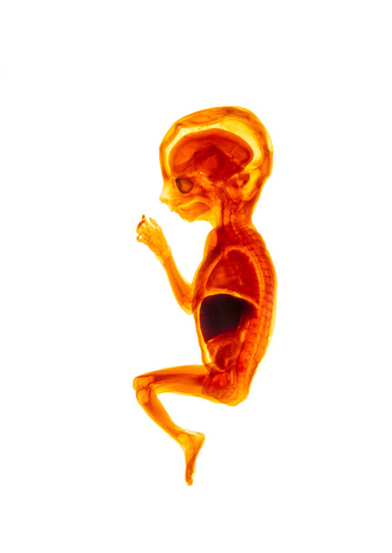 Reproducción de embriones humanos. Embriogénesis información cartel, desarrollo embrionario embarazo período, educación médica
 - Foto, imagen