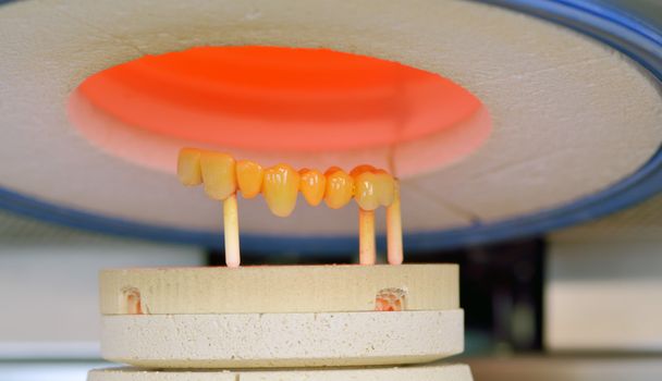 ceramic compound crowns in furnace - Photo, Image